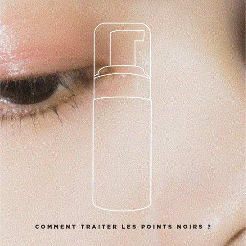 Comment traiter les points noirs