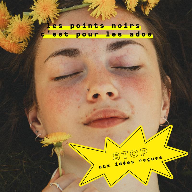 Stop aux idées reçues : Les points noirs c'est pour les ados !