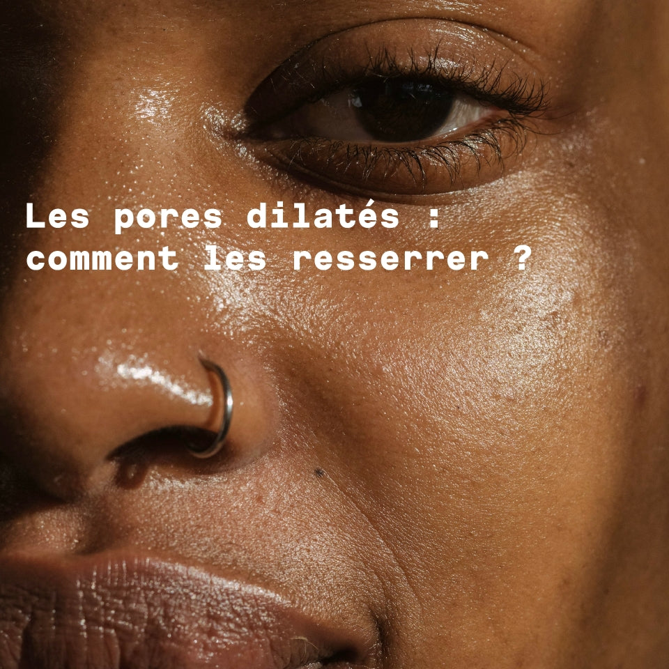 Dilated pores: how to tighten them?