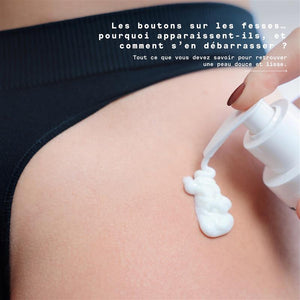 Boutons sur les fesses : pourquoi il faut hydrater ?