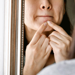 Hormonal acne during menstruation: avoiding pimples